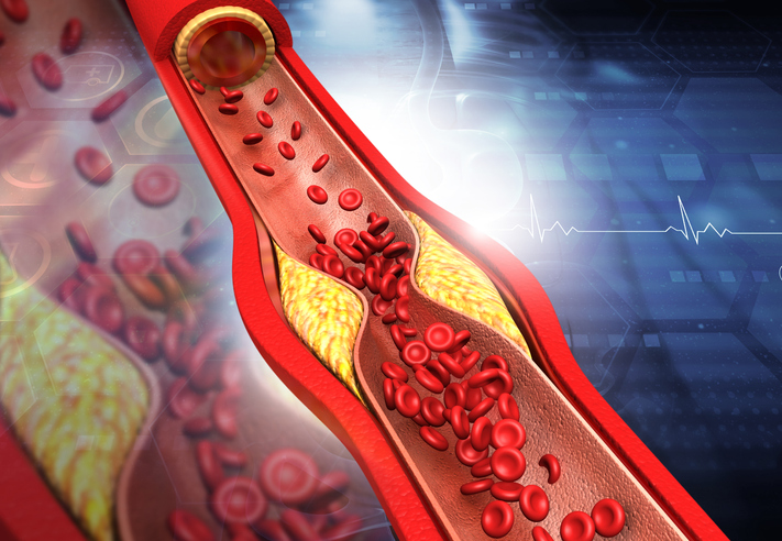 Qué es el colesterol y por qué hay que controlar sus niveles