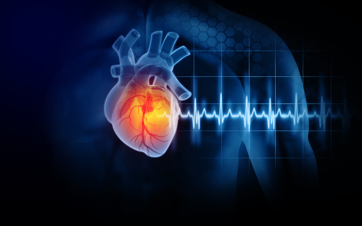 El infarto de miocardio: cómo se produce y qué puedes hacer para prevenirlo