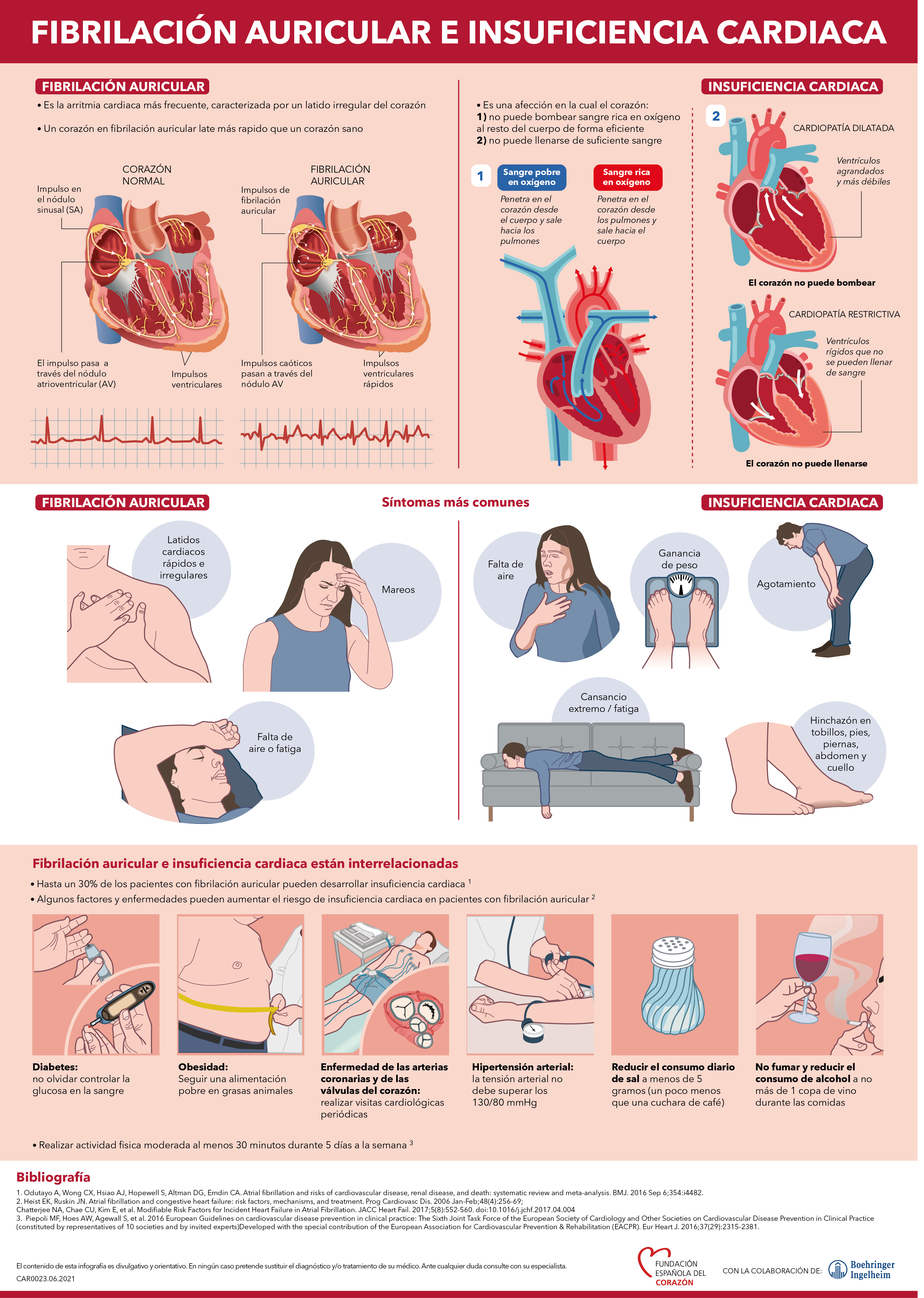 Fibrilación auricular e insuficiencia cardiaca